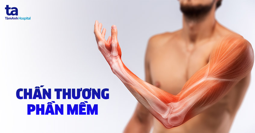 chấn thương phần mềm